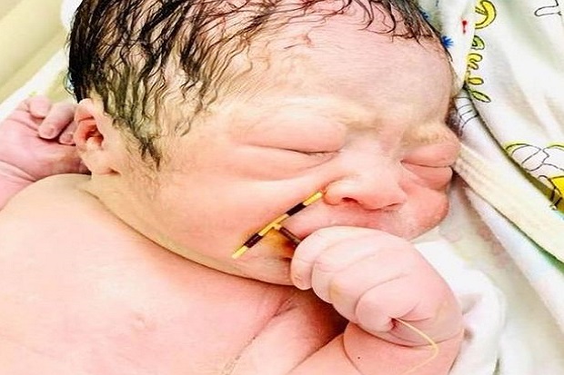 Bayi Ini Terlahir Genggam...