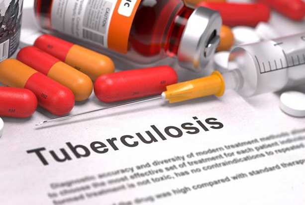 Kasus Tuberkulosis di...