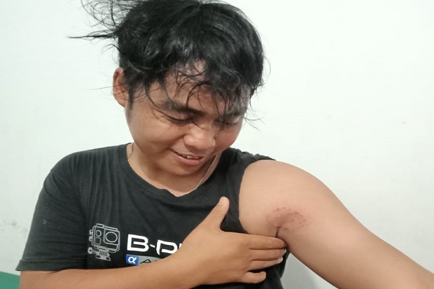 Kocak! Polisi Digigit...
