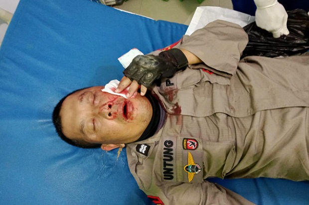 2 Anggota Polisi Terluka...