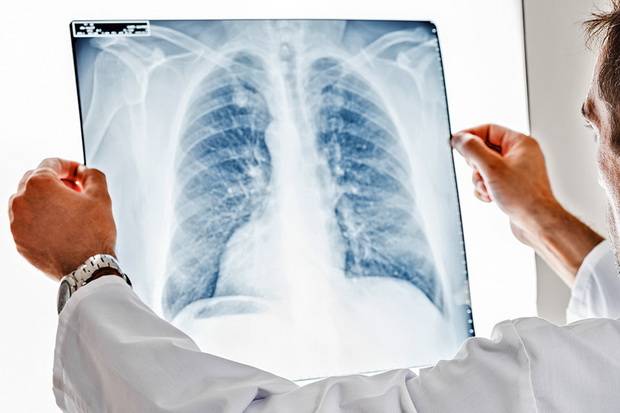 Pneumonia Butuh Penanganan...
