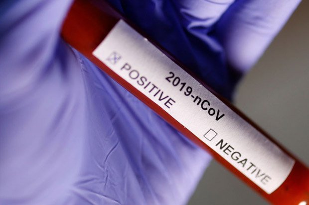Kasus Positif COVID-19...