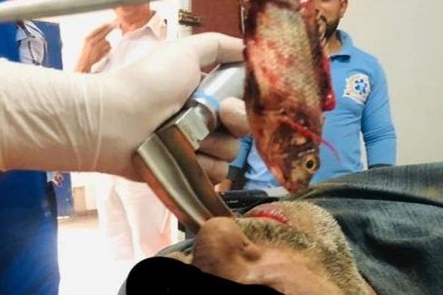Dokter Keluarkan Ikan...