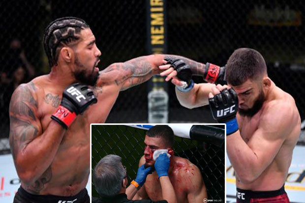 UFC Gempar!! Telinga...