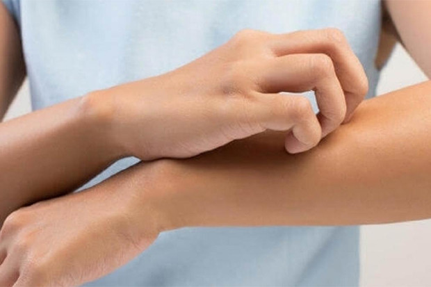 Mengenal Jerawat Genital...