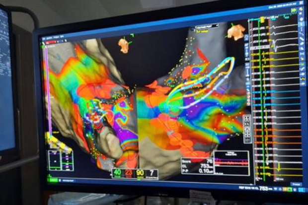 Teknologi HD Grid 3D...