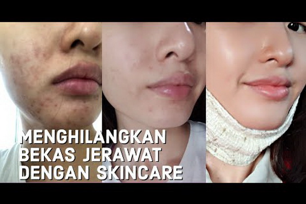 Gak Pede dengan Bekas...
