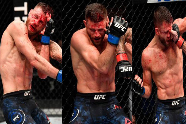Calvin Kattar Meregang...