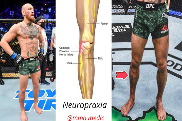Conor McGregor Cedera...