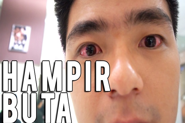 Gegara Softlens, Kevin...