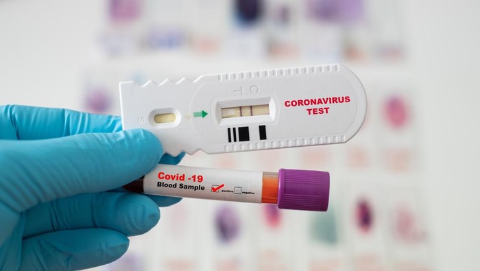 Kasus Rapid Antigen...