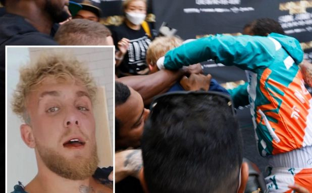 Mata Lebam, Jake Paul:...