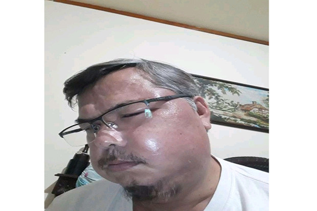 Warga Pondok Aren Bengkak...