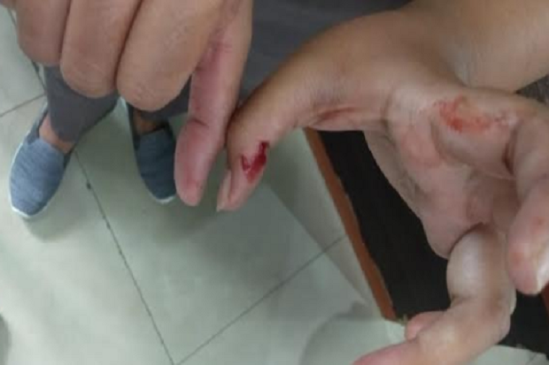 Ngamuk Hingga Melukai...