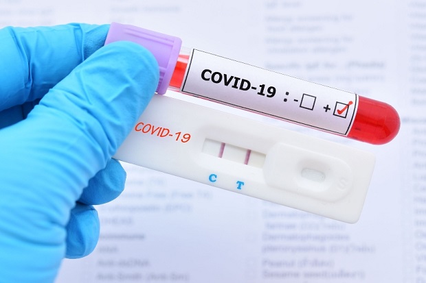 Hasil Tes Antigen Negatif...