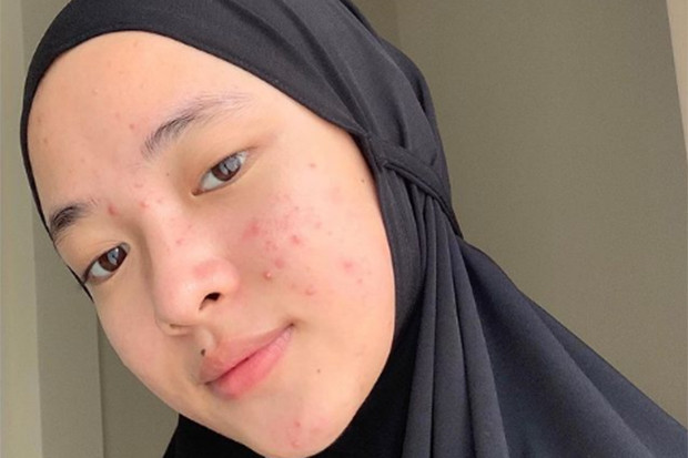 Nissa Sabyan Tampil...