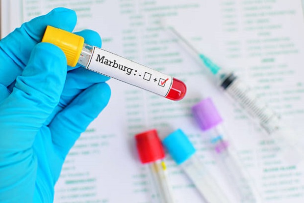Virus Marburg Sampai...