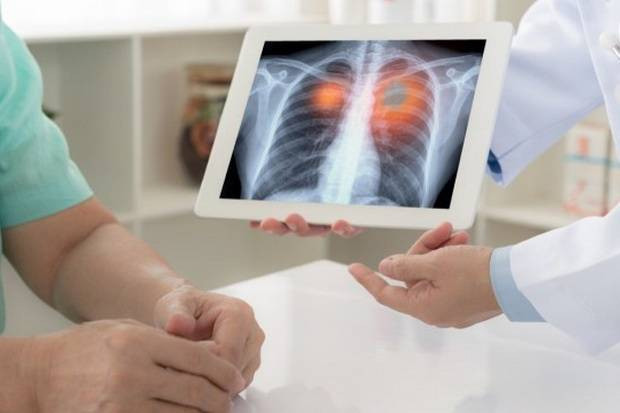 Dokter Sebut Ada Kemungkinan...