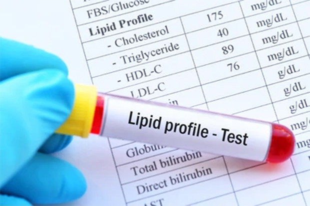 Lalai Kelola Kadar Lipid,...