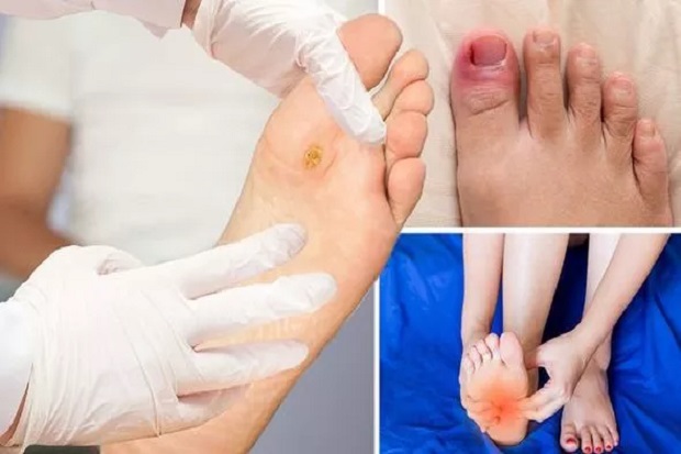 Gejala Diabetes Tipe...
