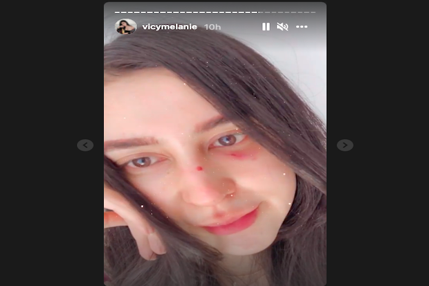 Wajah Vicy Melanie Istri...
