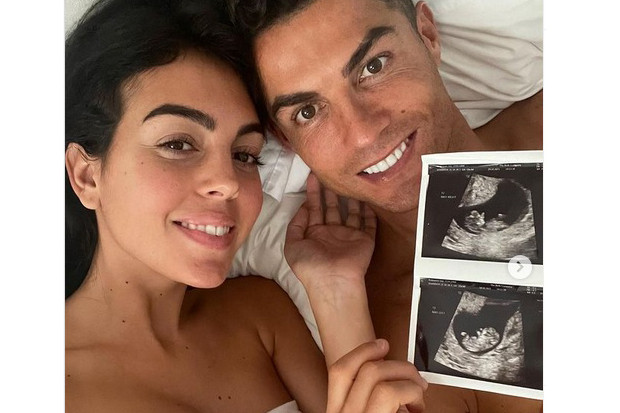 Ronaldo Pamer Foto Kehamilan...