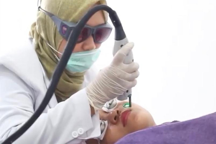 Treatment Laser untuk...