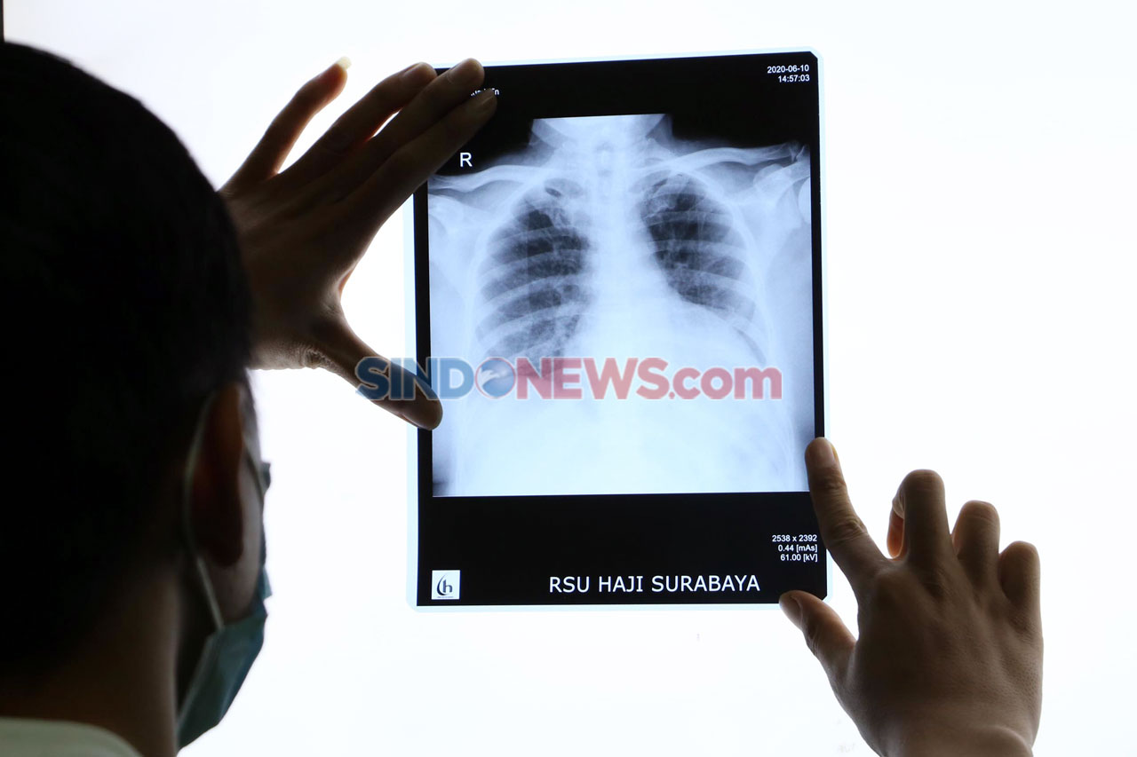 Tim Medis RSU Haji Surabaya...