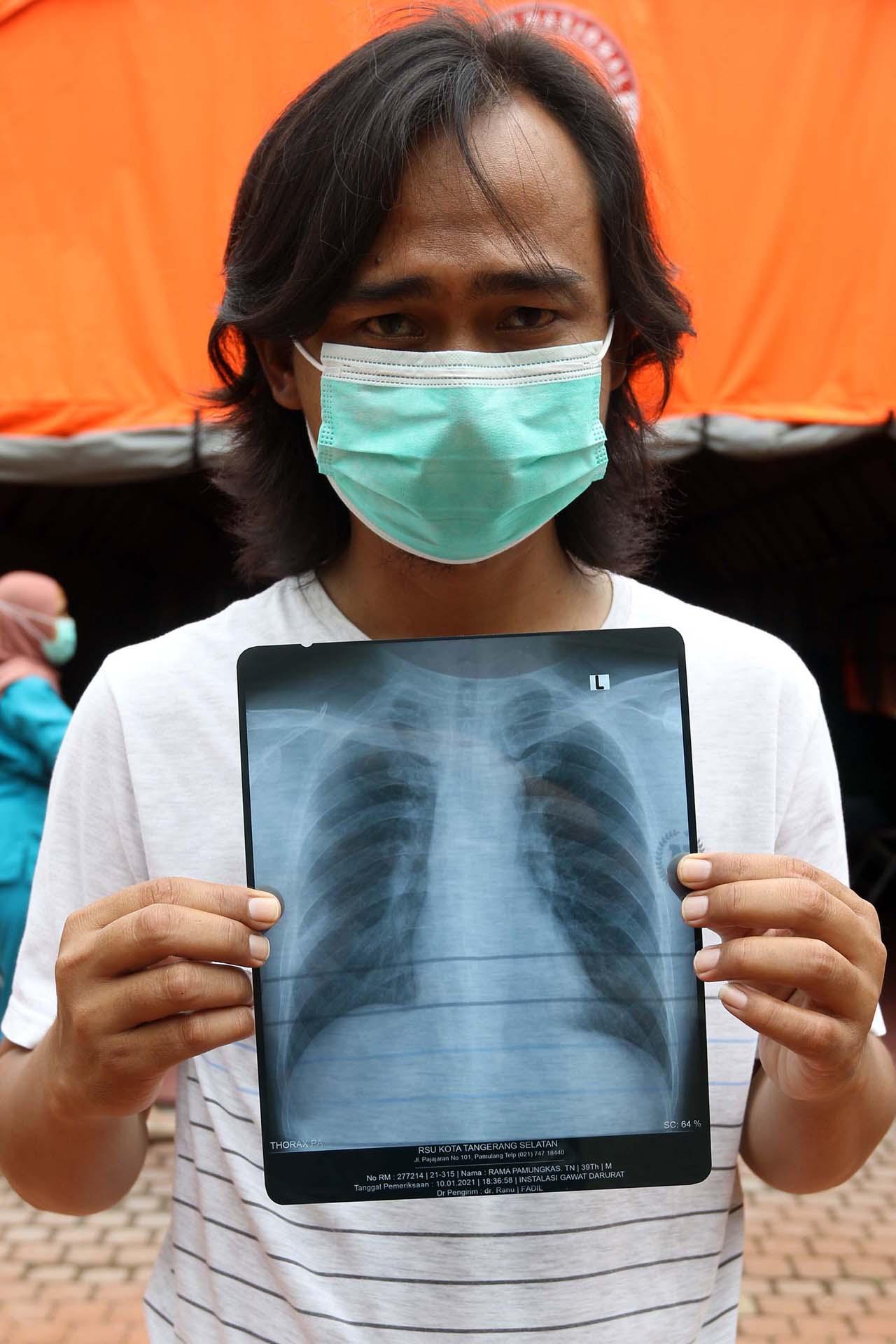 Sembuh dari Covid-19,...