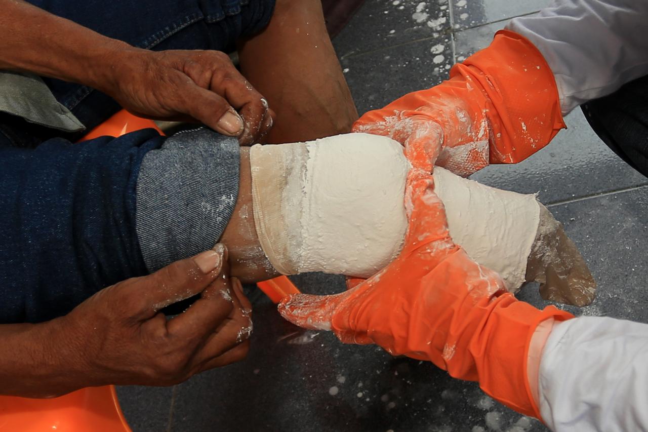 Bantuan Kaki Palsu Bagi...