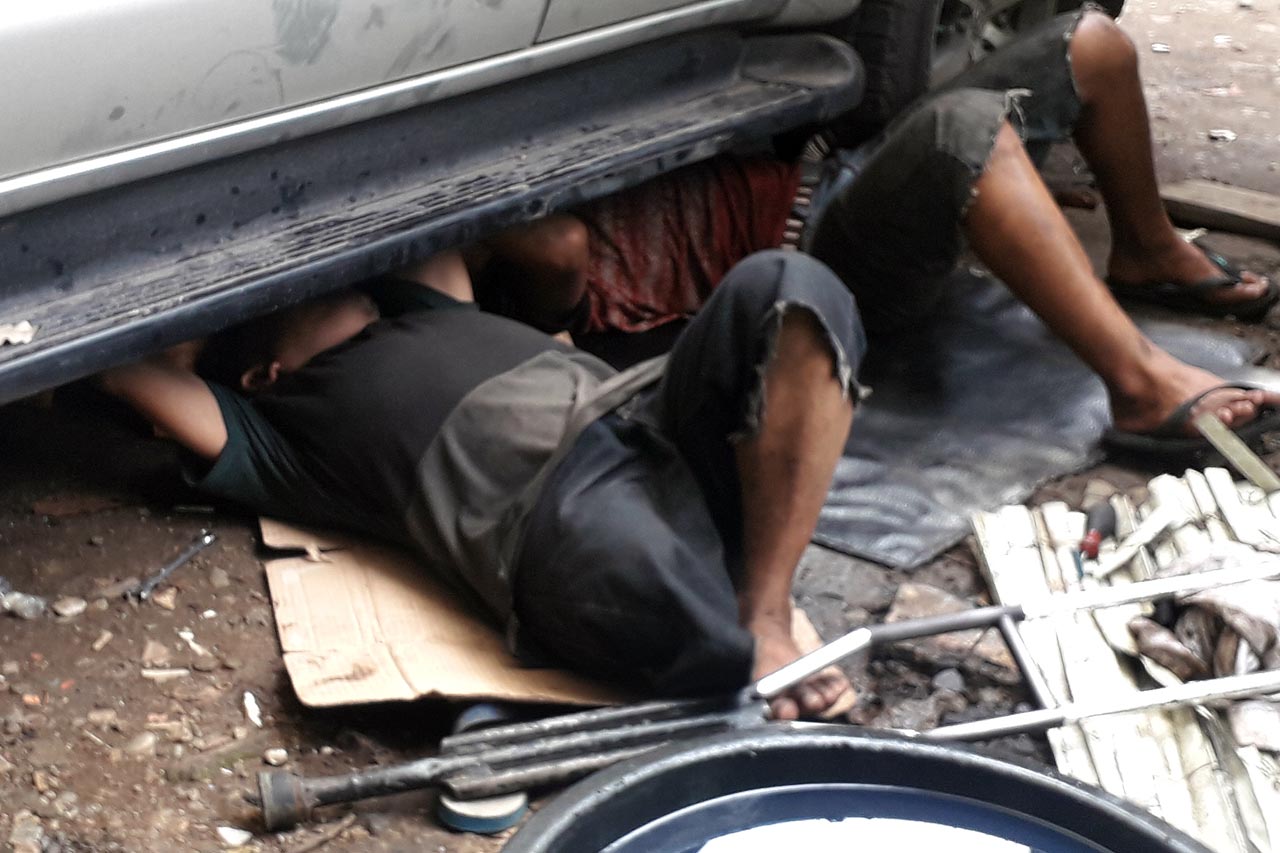 Kehilangan Satu Kaki...