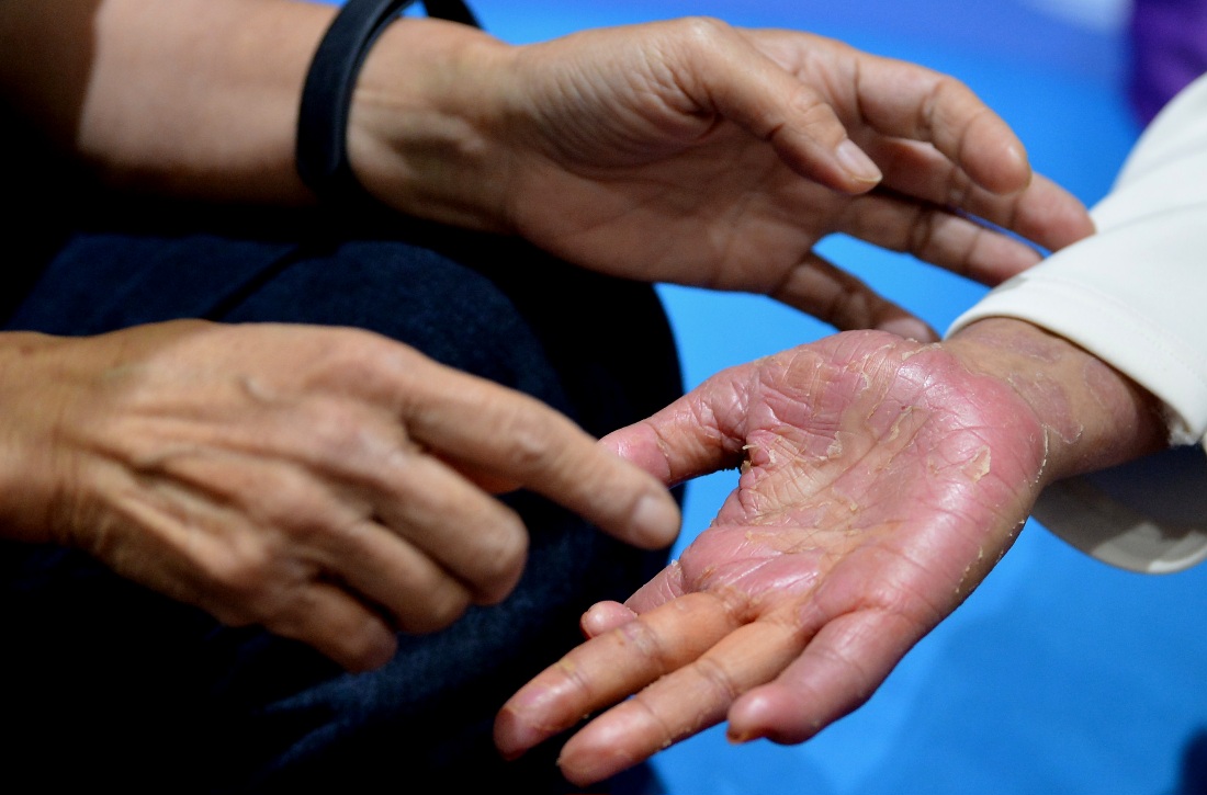 ERHA Atopy & Skin Disease...