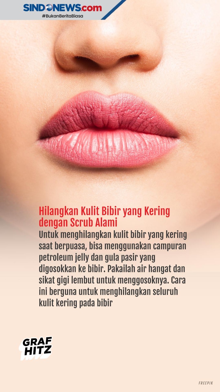 Cara Mengatasi Bibir...