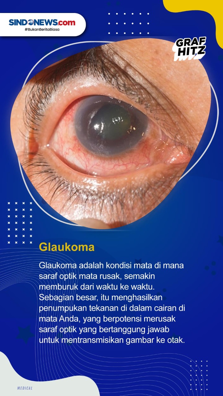 5 Gangguan Penglihatan...