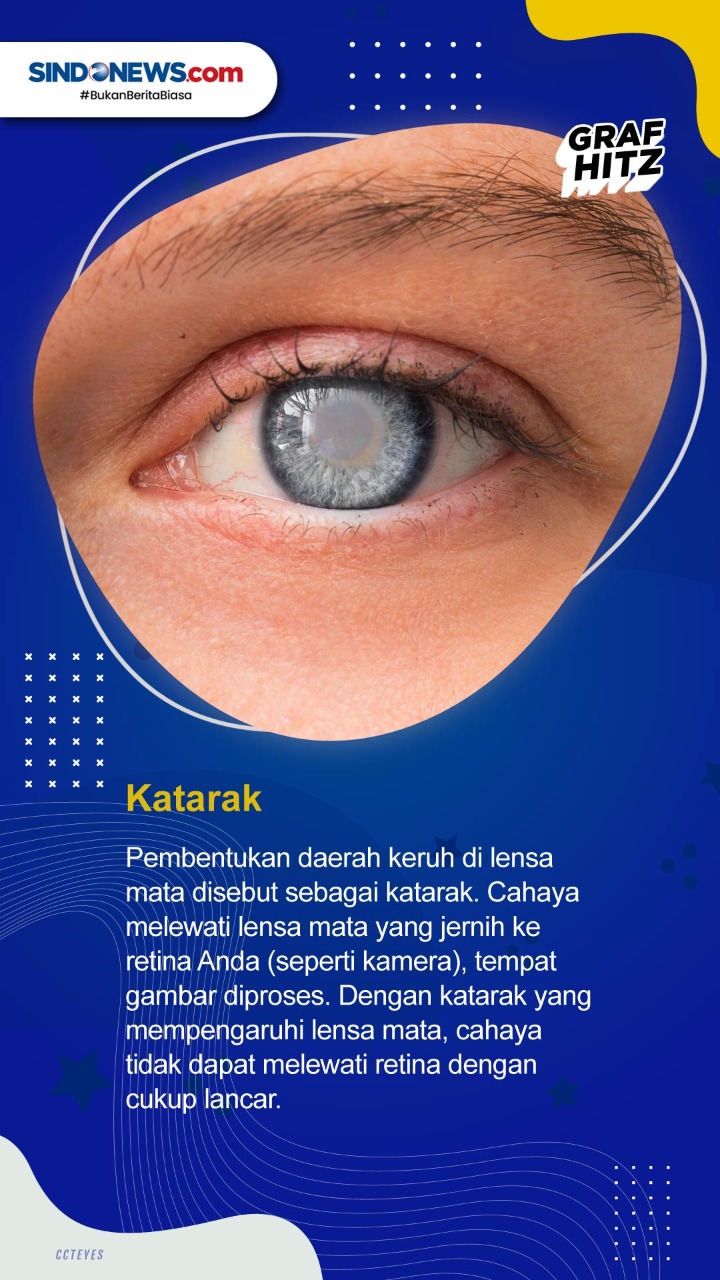 5 Gangguan Penglihatan...