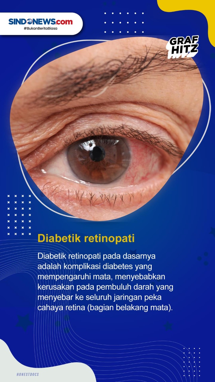 5 Gangguan Penglihatan...