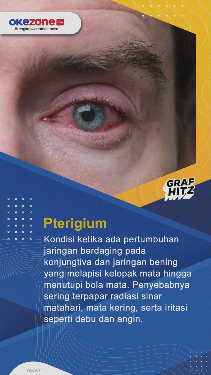 Waspadai dan Kenali...