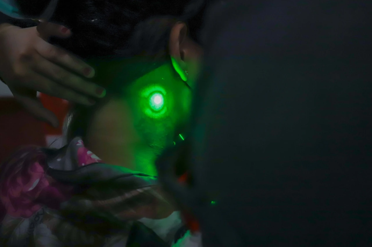 Layanan Hapus Tato Gratis...