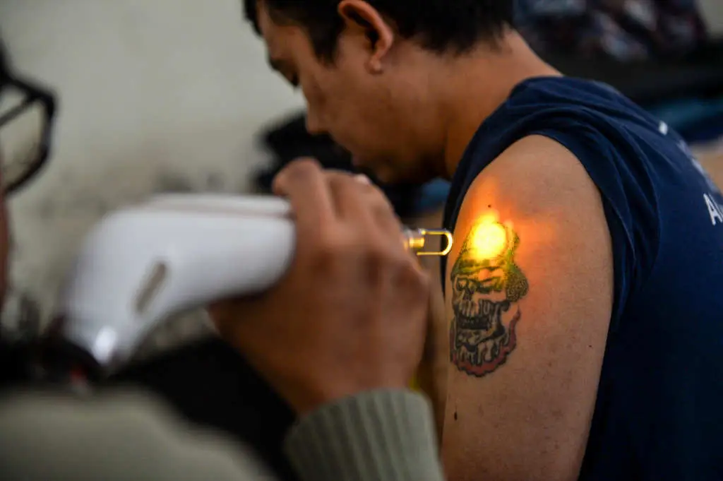 Program Hapus Tato Gratis...