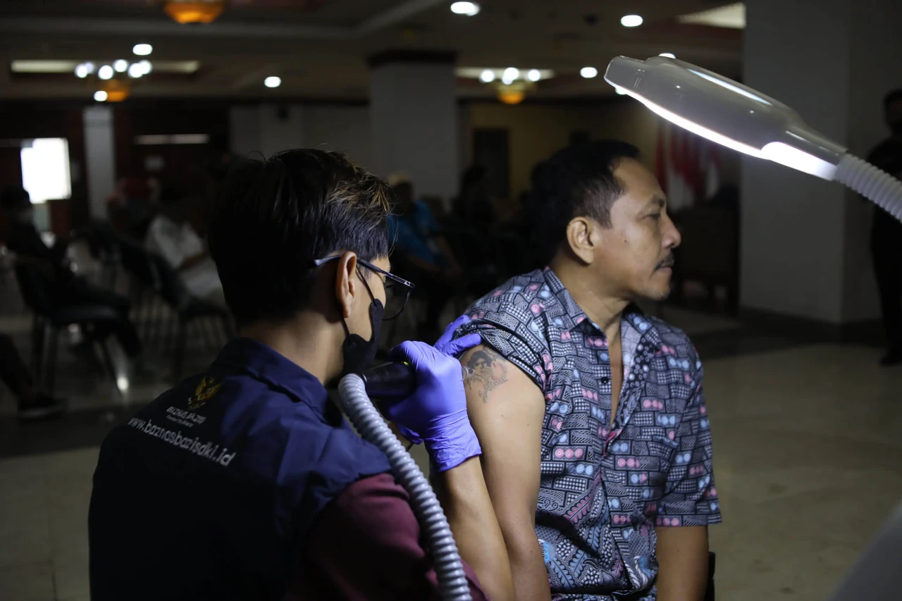 Layanan Hapus Tato Gratis...