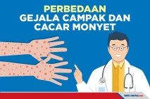 Perbedaan Gejala dan...