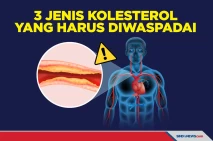 Penting Diketahui! Tiga...