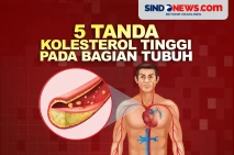 5 Tanda Bahaya Kolesterol...