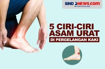 5 Ciri Asam Urat di...