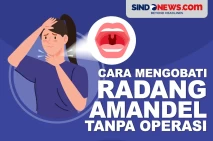 5 Cara Mengobati Radang...