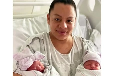 Unik! Bayi Kembar Ini...