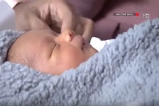 Hidung Baby L, Anak...
