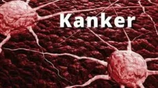 Kasus Kanker Masih Tinggi,...
