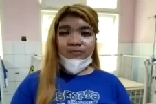 Miris! Gadis Manado...
