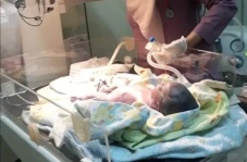 Bayi di Bandung Alami...